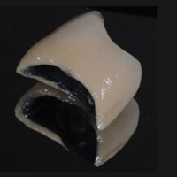 металлокерамика коронка на зуб жевательный